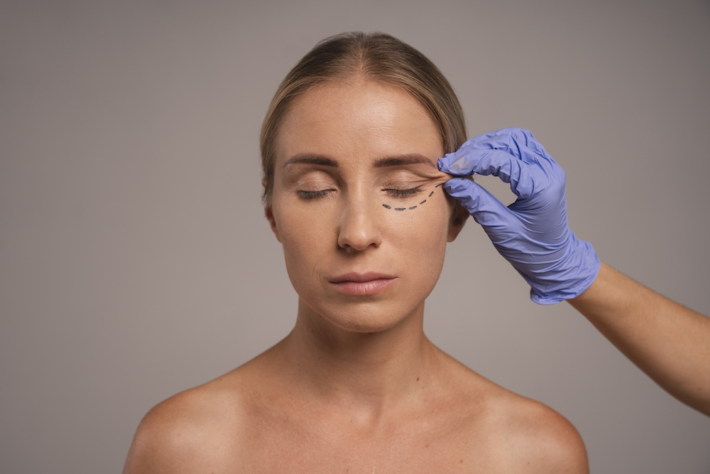 Ragazza che si sottopone a visita per vedere se fare una blefaroplastica chirurgica o non chirurgica